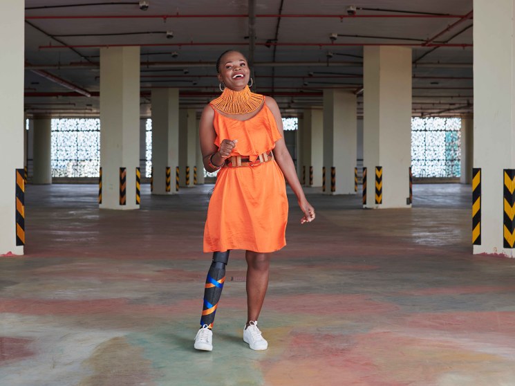 A lady with a prosthetic leg.