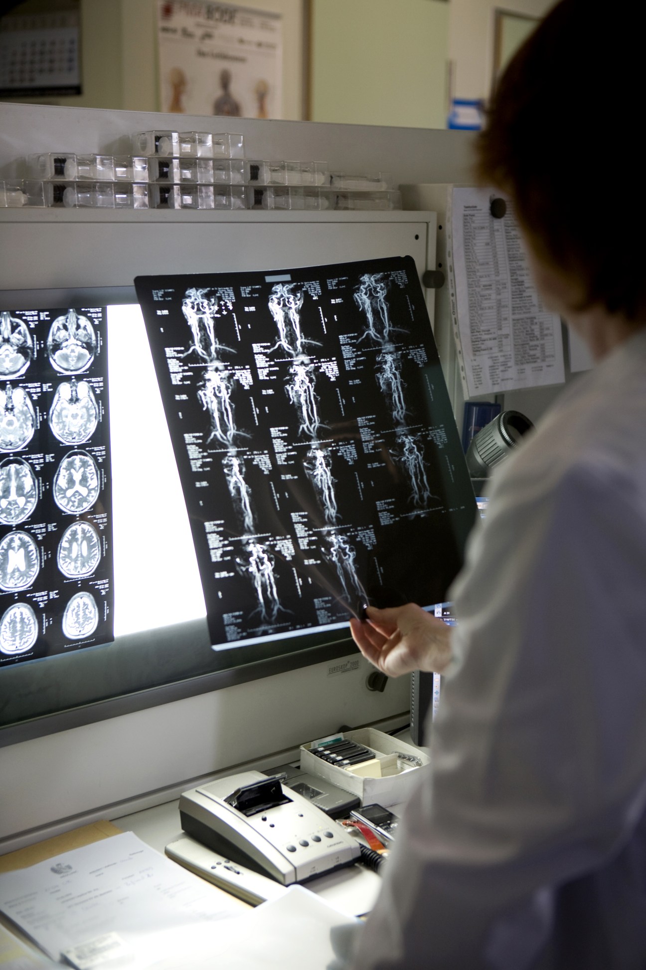 A doctor at Berlin's Meoclinic examines tomography images displayed on a lightbox.