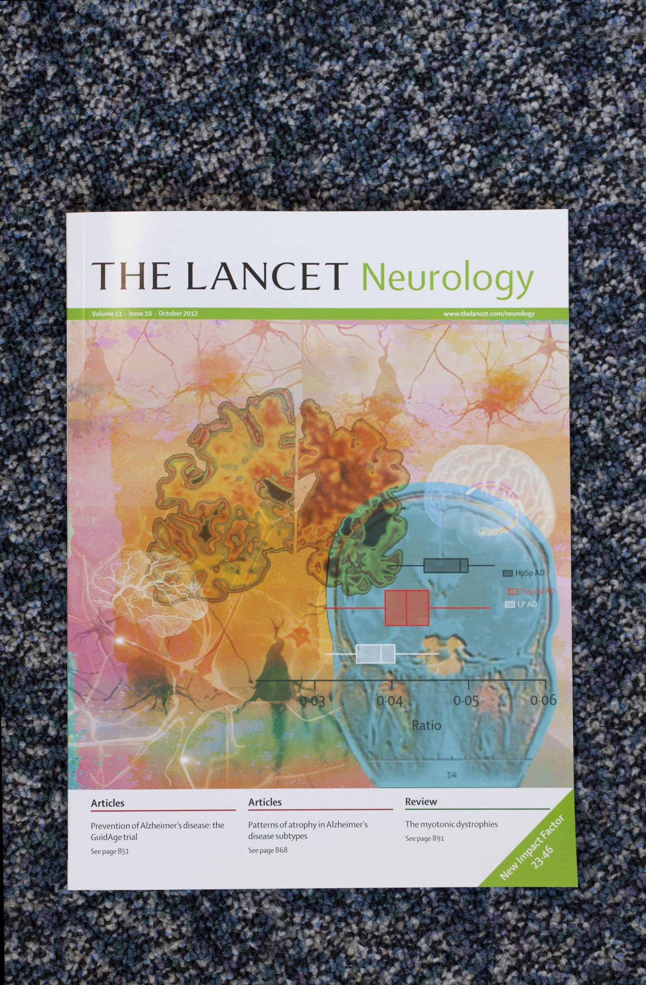 The Lancet Neurology October 2012 issue cover featuring colorful medical illustration of brain and neurons on textured background.